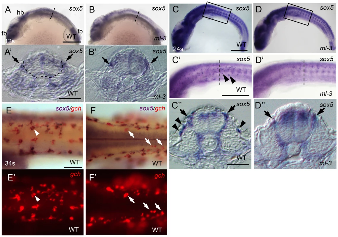 Expression pattern of medaka <i>sox5</i> in WT and <i>ml-3</i> mutant embryos.