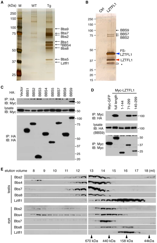Identification of LZTFL1 as a BBSome interacting protein.