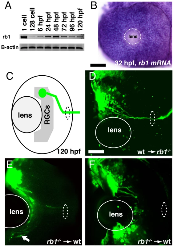 <i>rb1</i> is required in RGC axons to regulate retinal exit.