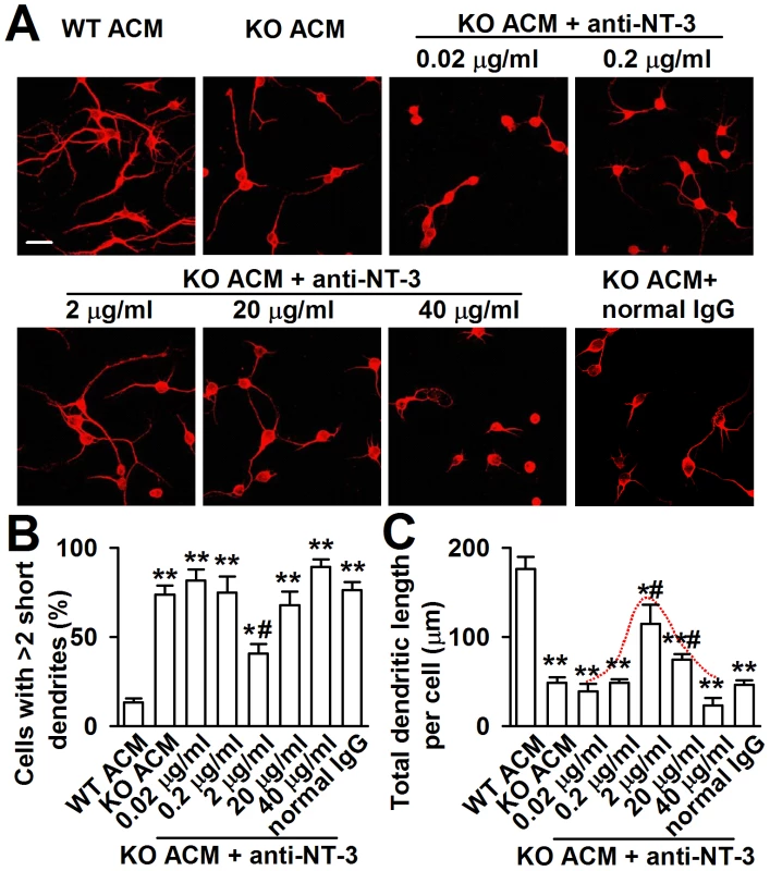 Effects of NT-3 neutralizing antibody on the neuronal dendritic growth.
