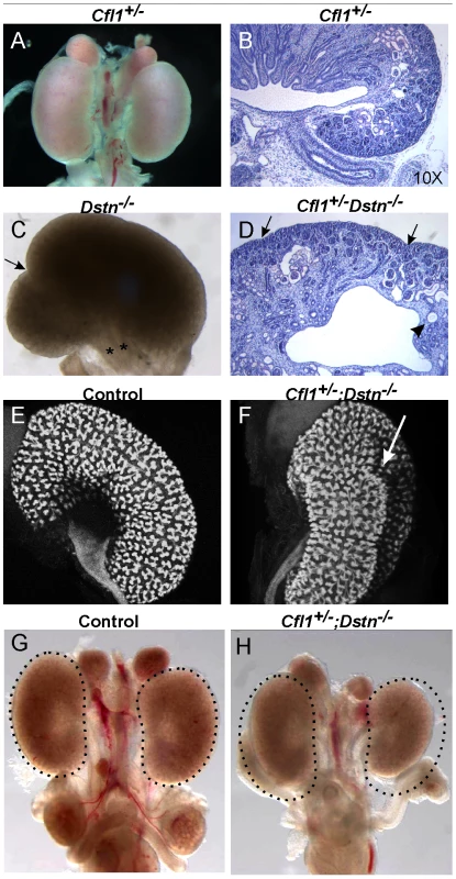 Kidney defects in <i>Dstn<sup>−/−</sup></i> and <i>Cfl1<sup>+/−</sup></i>;<i>Dstn<sup>−/−</sup></i> mutant animals.