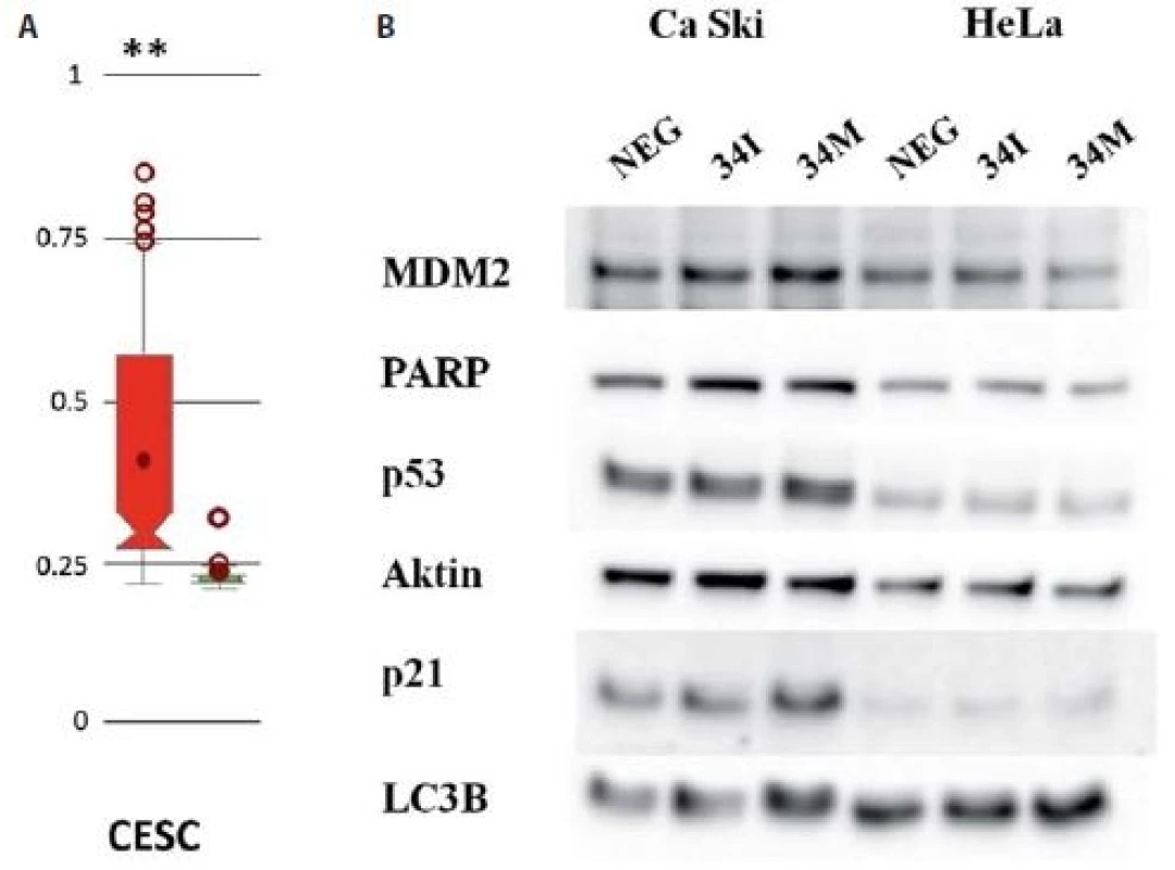 A) Analýza metylací promotoru miR-34c s využitím online databáze MetHC.
Intenzita metylace promotoru pro miR-34c byla porovnávána mezi vzorky pocházejícími
ze souboru CESC a zdravými kontrolami (vlevo); **p < 0,005. B) Imunochemická
analýza změn exprese vybraných proteinů po transfekci buněk Ca Ski a HeLa inhibitorem
miR-34c (34I) a miR-34c mimikujícími oligonukleotidy (34M).