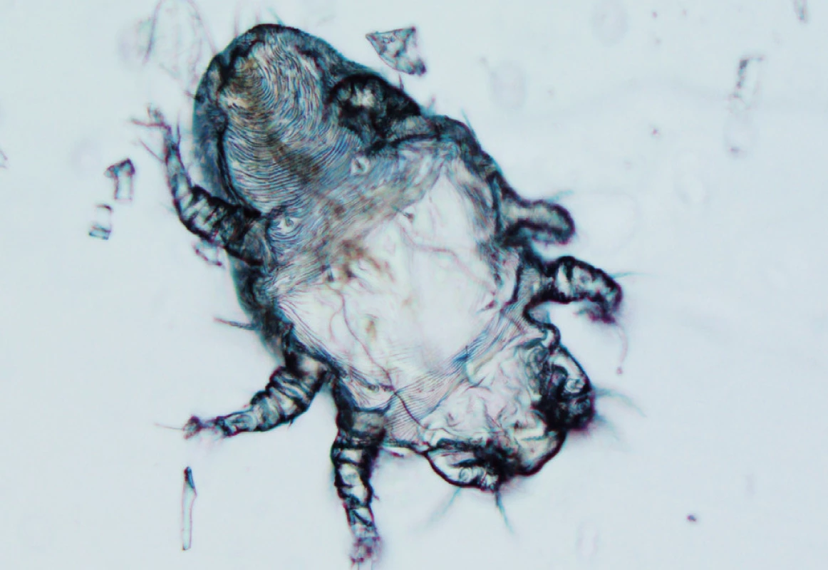 Cheyletiella – larva s 3 páry nohou