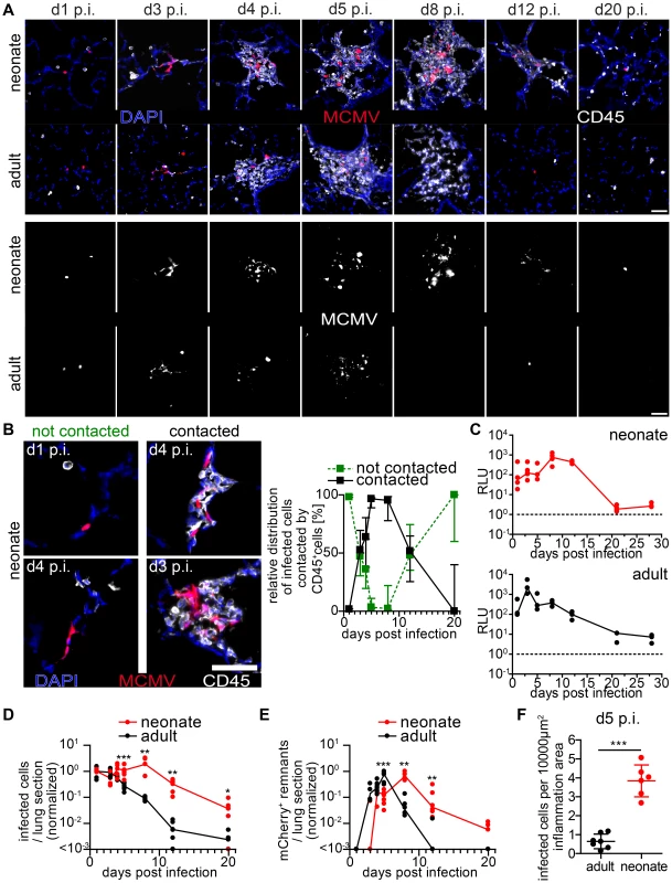 Delayed control of lung MCMV infection in neonatal mice.