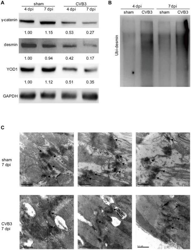 CVB3 infection disrupts desmosomes <i>in vivo</i>.