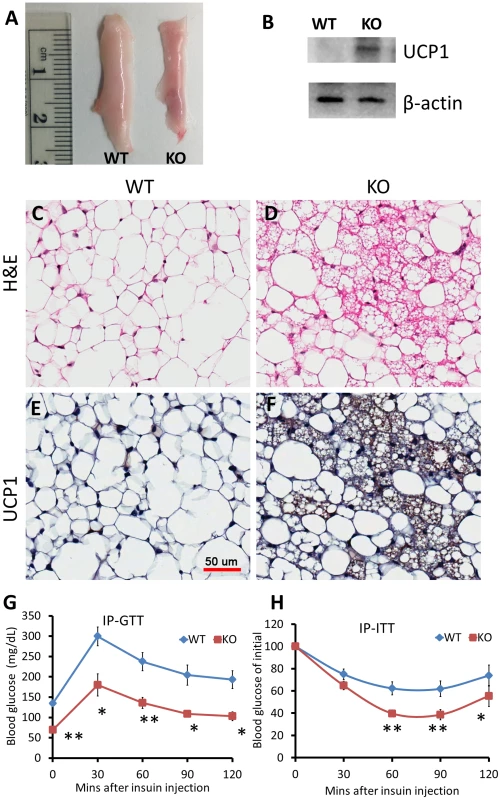 Knockdown of miR-133a leads to browning of WAT and improves body insulin sensitivity in vivo.