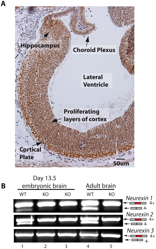 T-STAR protein is expressed in the embryonic brain.
