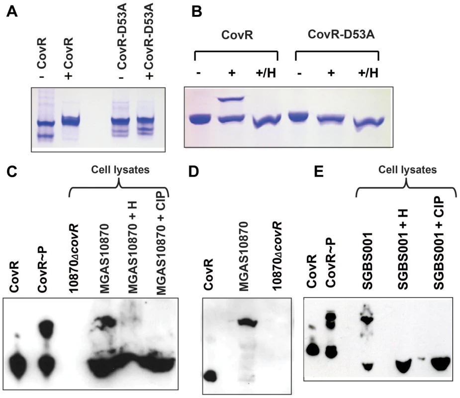 Detection of CovR phosphorylation <i>in vitro</i> and <i>in vivo</i>.