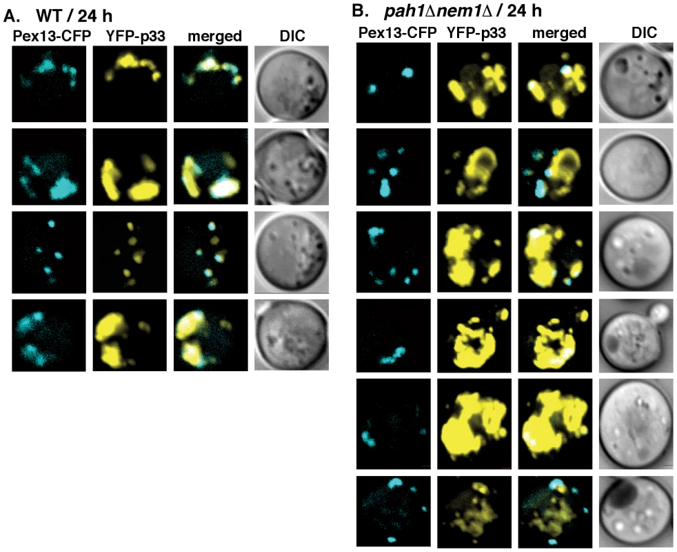 Only a small portion of the tombusvirus p33 replication protein co-localize with peroxisomes in <i>pah1Δ nem1Δ</i> yeast.