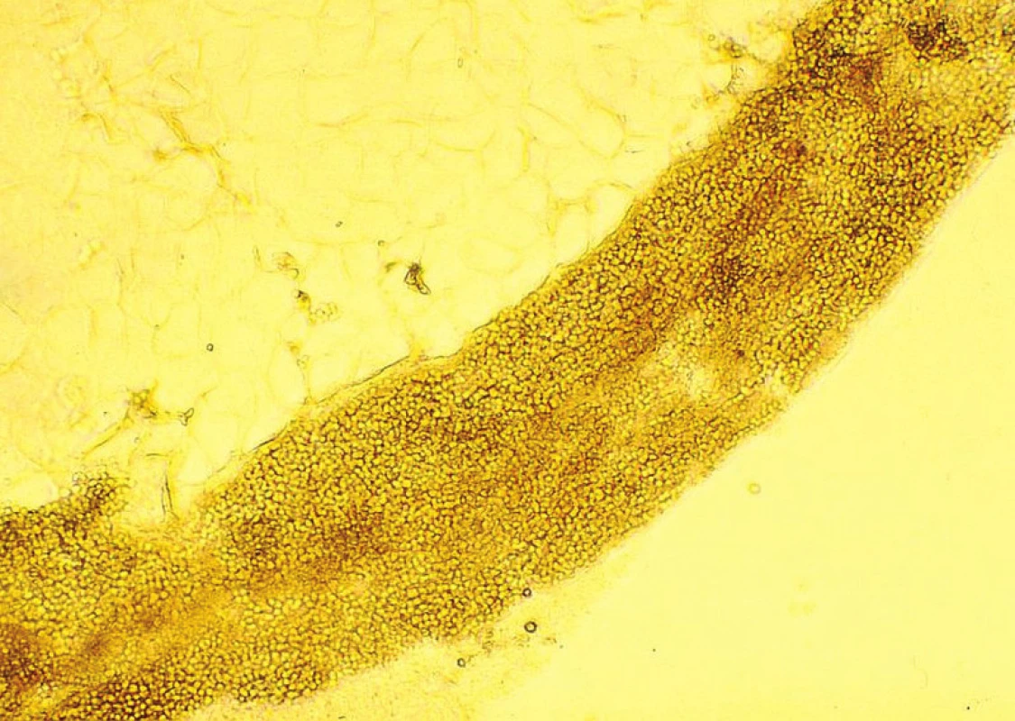 Mikroskopický obraz vo vlase – typ endothrix