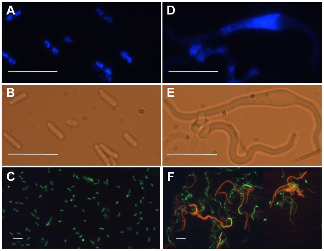 Fluorescence and phase-contrast micrographs of an <i>optA1 gpt</i> strain grown in the presence (A, B, C) or 7 hours in the absence (D, E, F) of hypoxanthine.