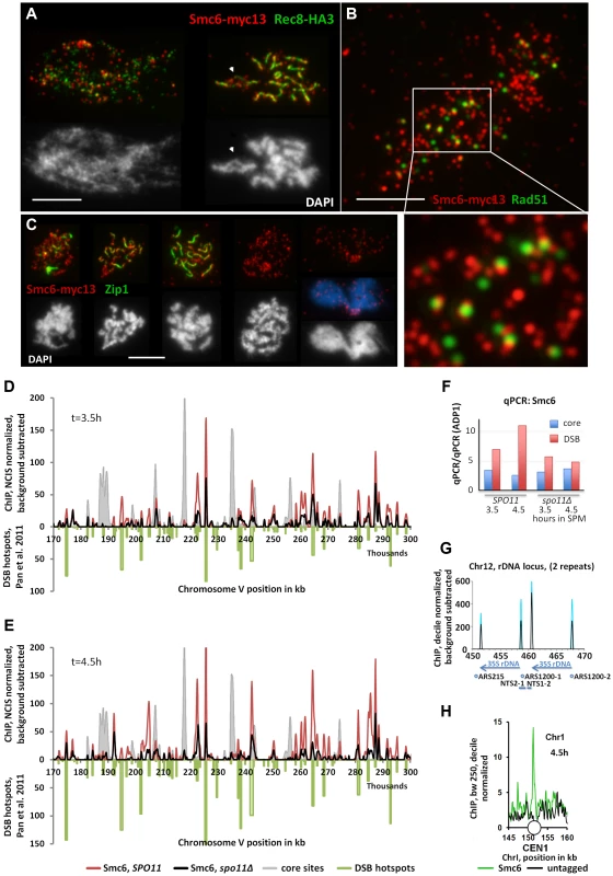 The Smc5/6-Mms21 complex binds early to meiotic chromatin and associates with sites of DSB repair.