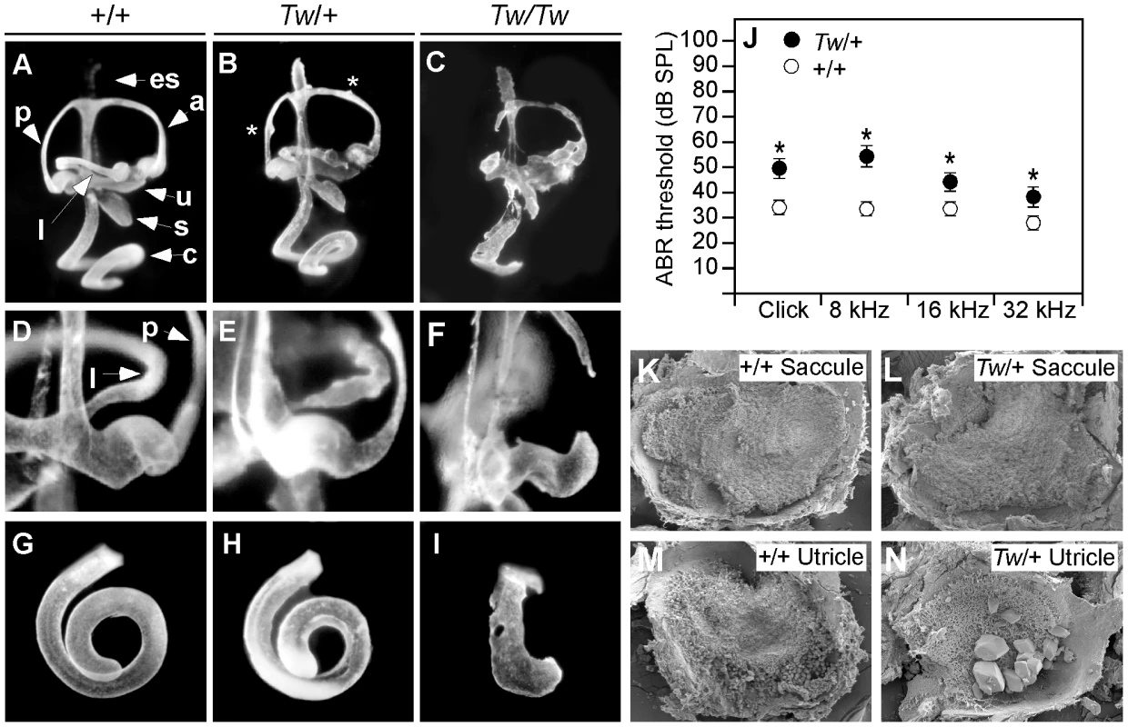 Inner ear morphology, hearing thresholds, and otoconia of Twirler mice.
