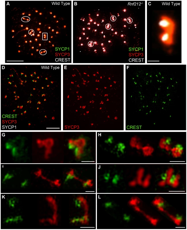 Identification of inter-centromeric SYCP3-staining bridges in diakinesis/metaphase I spermatocytes.