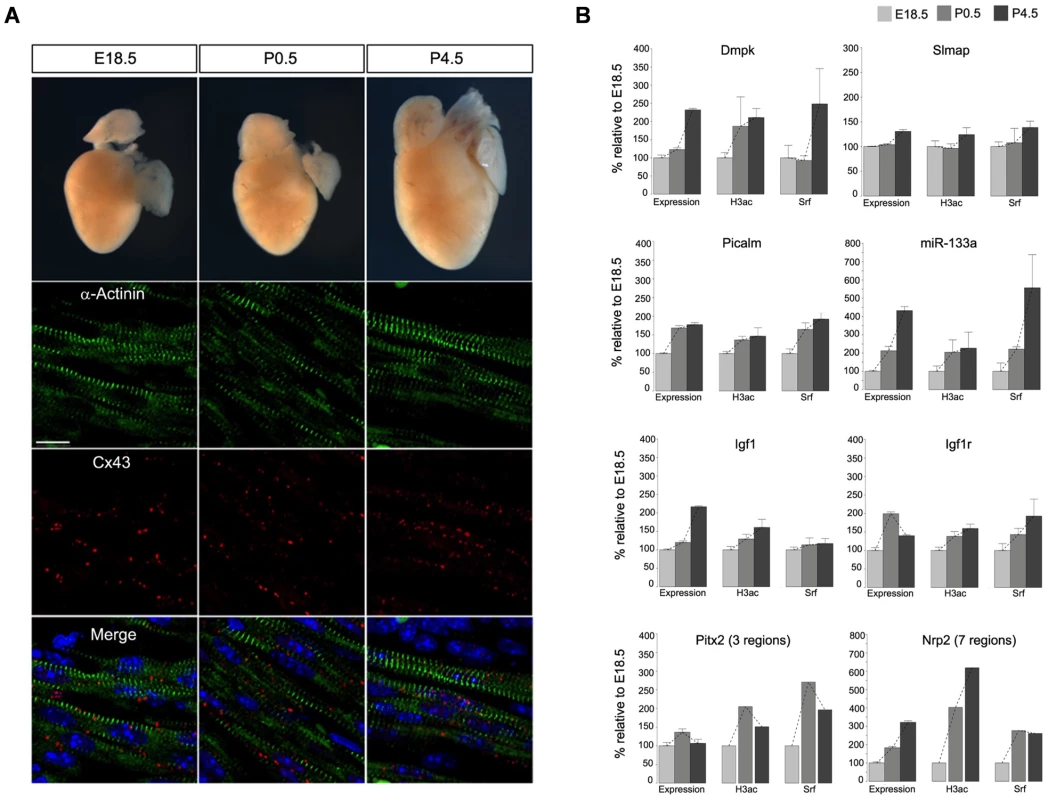 The impact of Srf and H3ac on gene expression in mouse hearts during cardiac maturation.