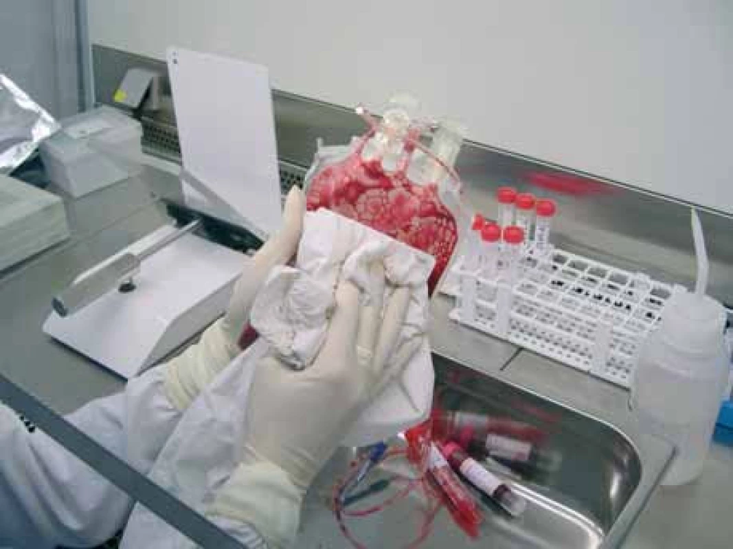 Přípravná fáze – dezinfekce odběrového vaku před zpracováním ve sterilním laminárním boxu – jiný úhel pohledu.