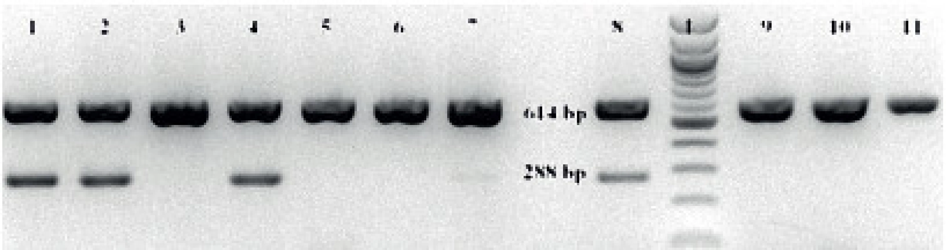 Výsledek gelové elektroforézy produktů PCR
Fig 2. The result of gel electrophoresis of PCR products