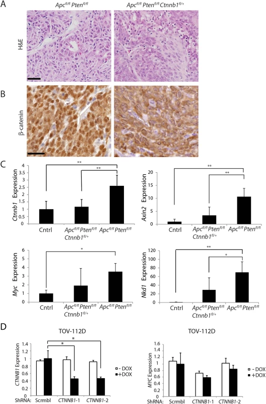 Heterozygous <i>Ctnnb1</i> inactivation does not prevent mouse ovarian endometrioid adenocarcinoma (OEA) development and the reduction in <i>Ctnnb1 dosage or CTNNB1</i> transcripts shows differential effects on selected β-catenin/TCF target genes.
