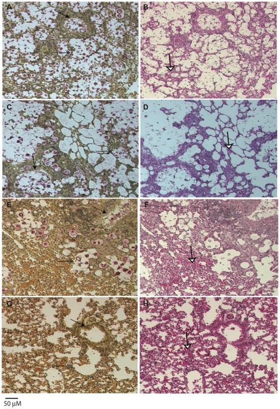 Histopathology of lungs of mice infected with <i>C. gattii</i>.