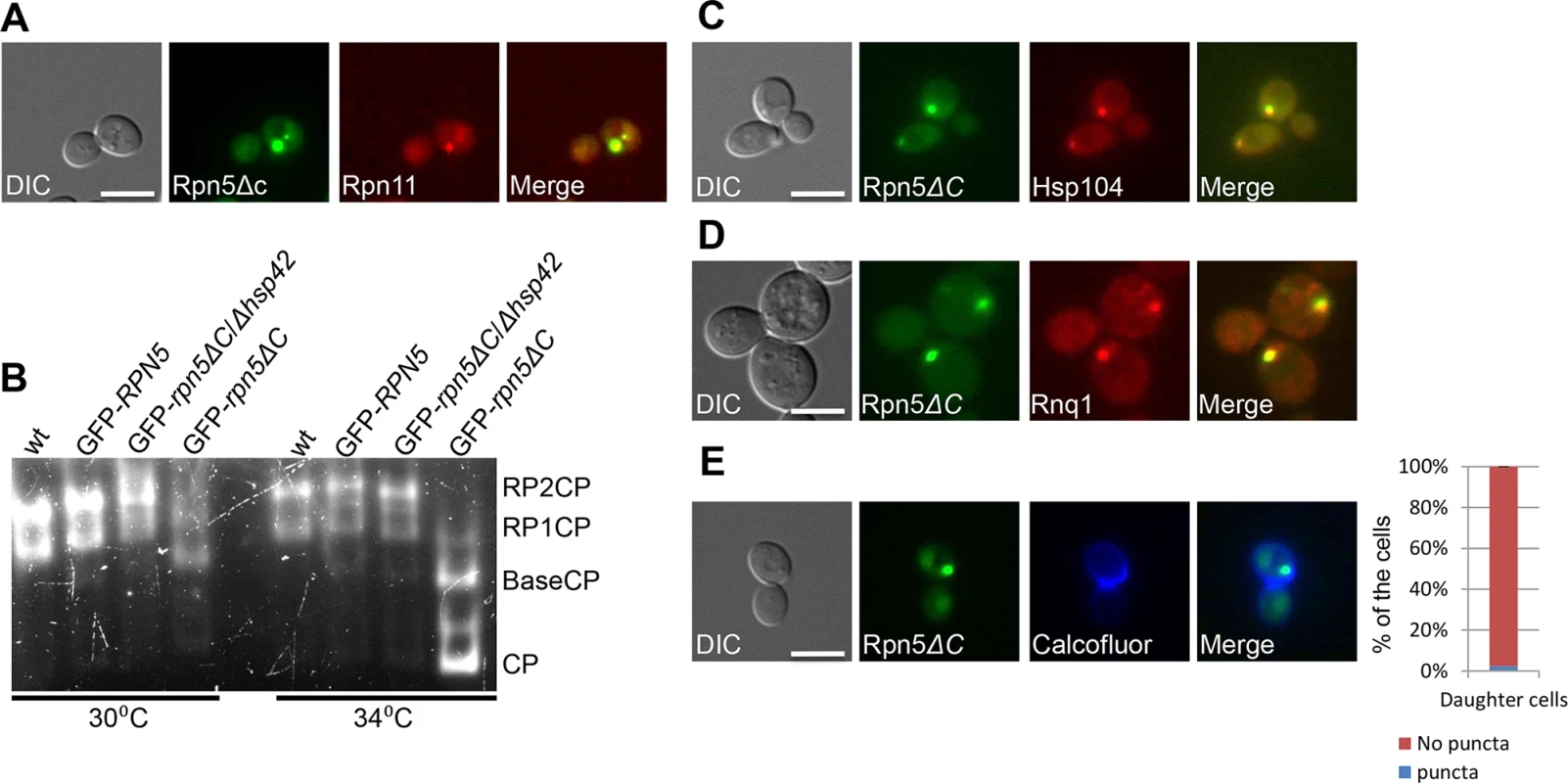 (A) The RP subunit Rpn11-RFP co-localizes with GFP-Rpn5ΔC. Logarithmically growing cells containing Rpn11 fused to RFP (Rpn11-RFP) and GFP-Rpn5ΔC (YSB1090) where grown in galactose containing medium at 30°C and shifted to 34°C for 3 hrs.