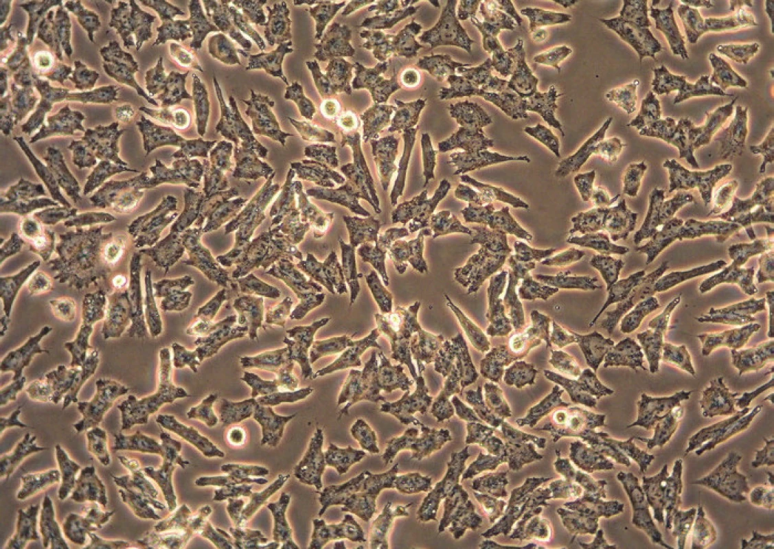 Fotografie z konfokálního inverzního mikroskopu zobrazující neuroblastomovou buněčnou linii UKF-NB-4. Cytostatikum ellipticin zelený signál, lysozomy červený signál, žlutá barva pak značí jejich kolokalizaci (originální zvětšení 400x).