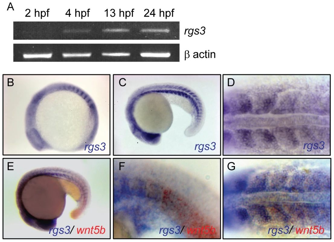 Temporal and spatial expression of <i>rgs3</i> throughout zebrafish development.