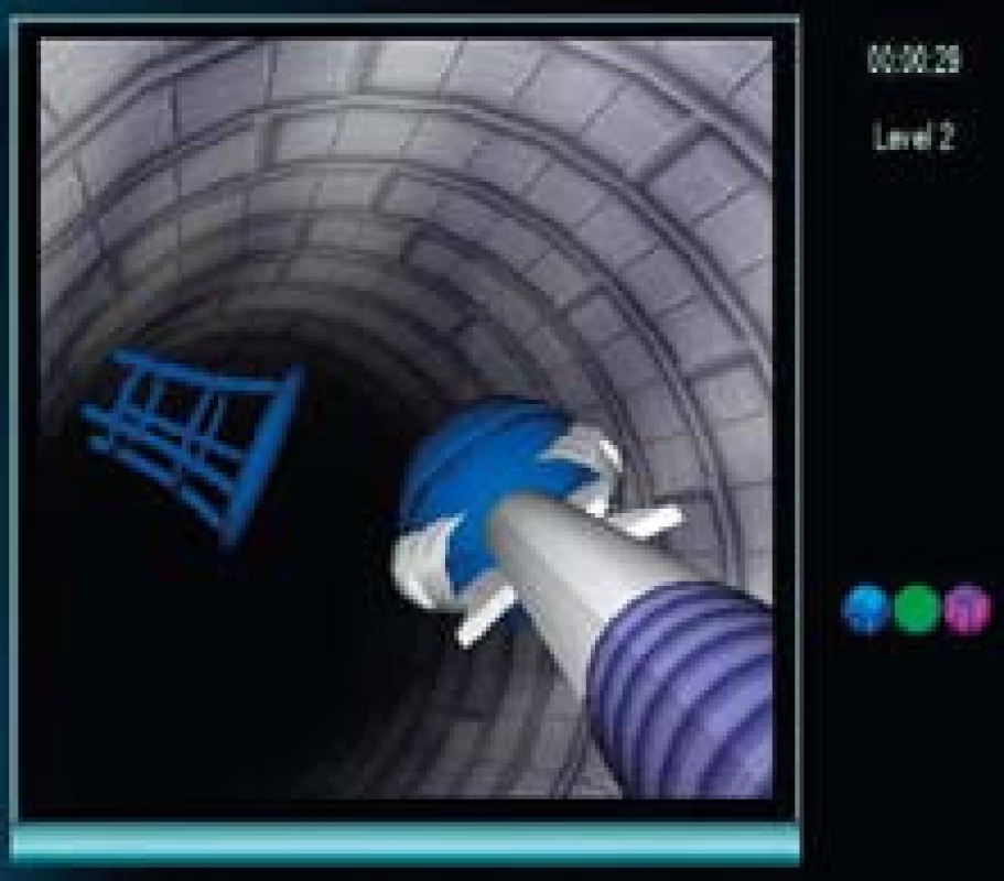 Výcvikový program EndoBasket. Na počítačovém displeji se zobrazuje vinutý tunel s balonky a košíky. Úkolem výcviku je zachytit balonek endoskopickými klíšťkami a vložit ho do košíčku stejné barvy.
Fig. 3. EndoBasket Exercise Programme. The video display shows a winding tunnel with balls and baskets. The object of the exercise is to grasp the ball with the endoscopic forceps and drop it into the basket of the same colour.