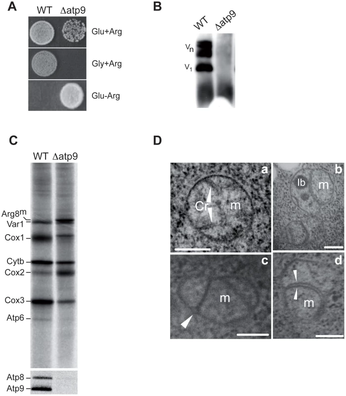 Deletion of the yeast mitochondrial <i>ATP9</i> gene and resulting phenotypes.