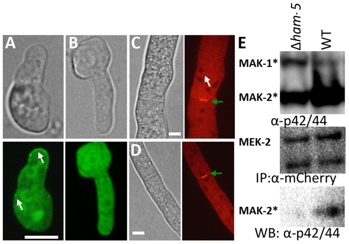 HAM-5 is required to localize MAK-2 and MEK-2 to puncta.