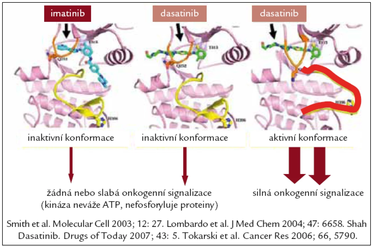 Interakce imatinibu s kinázovou doménou Bcr-Abl, u dasatinibu v inaktivní a aktivní konformaci.