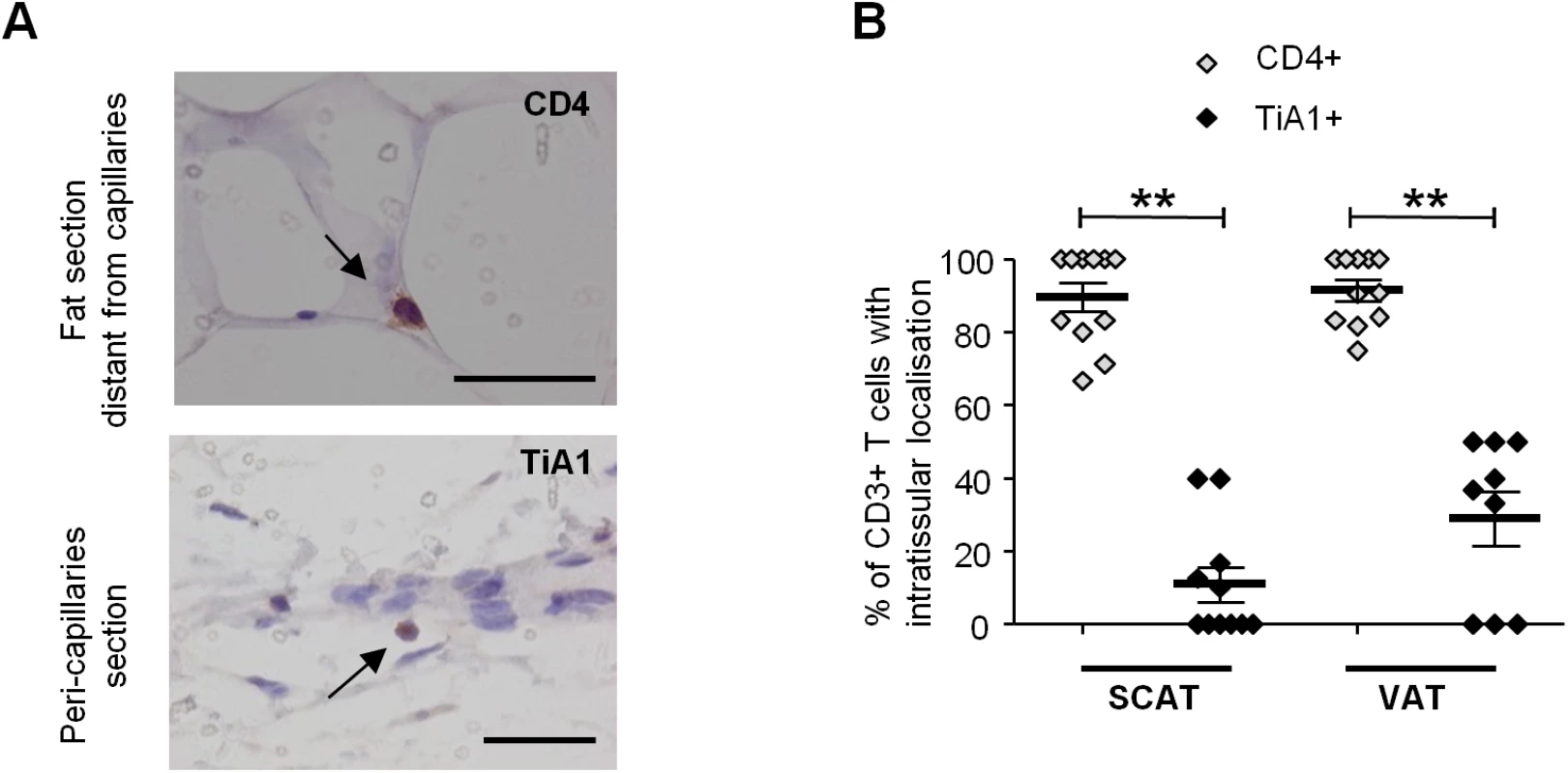 Localization of T cells in the adipose tissue of SIV-infected animals.