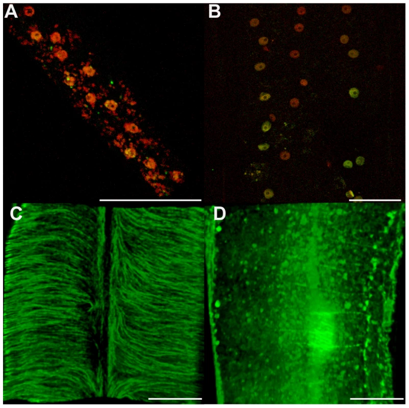 Cytoskeleton defects are revealed in somatic tissues, without apoptotic phenotypes.