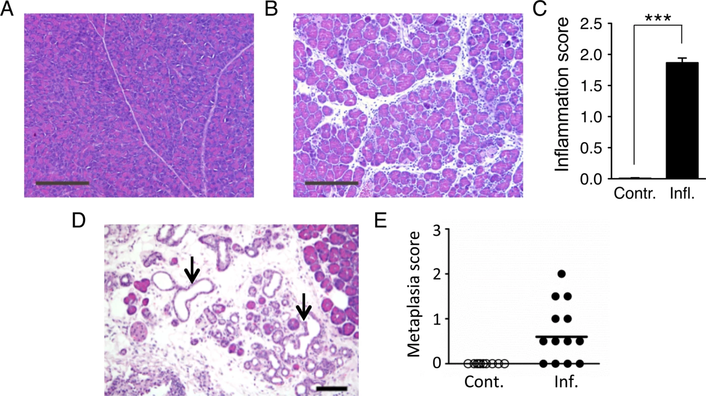 Cerulein treatment induces inflammation in the pancreas, and chronic cerulein pancreatitis induces metaplastic changes.