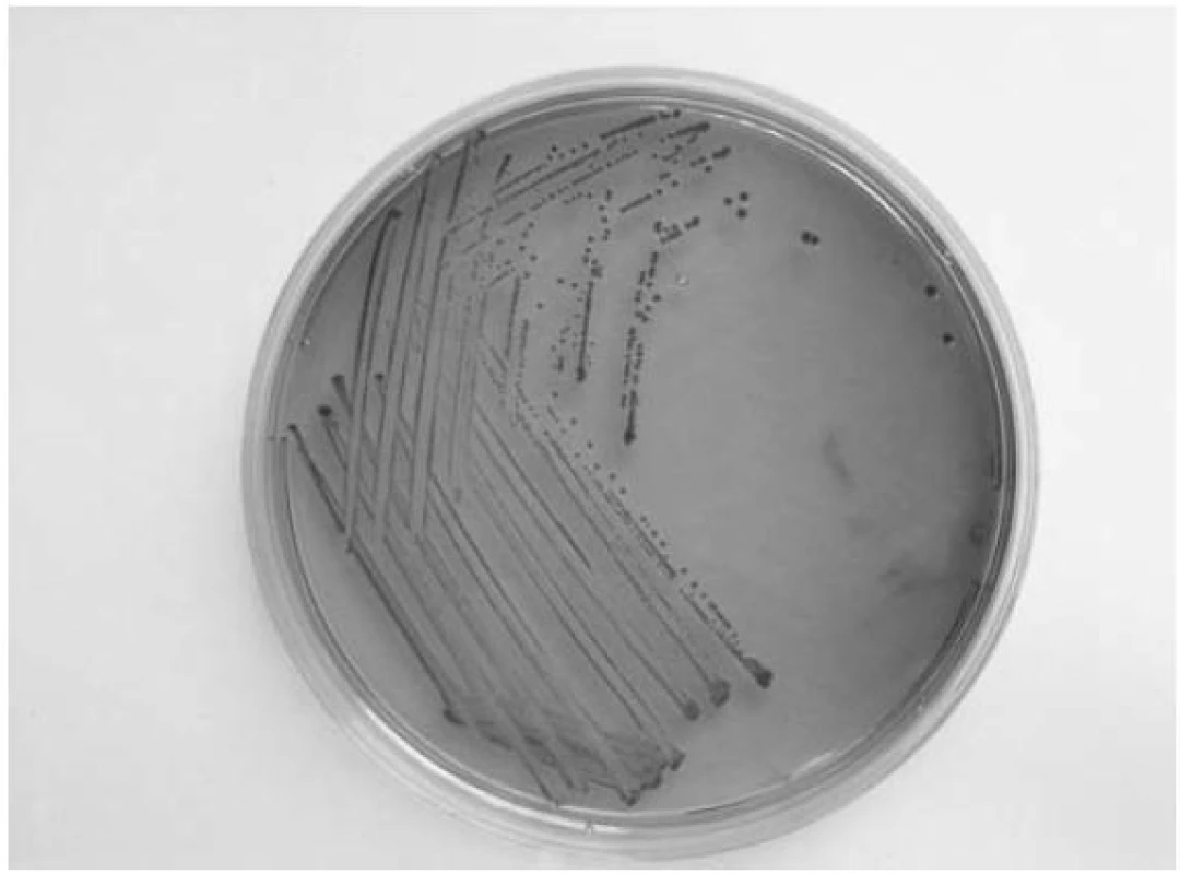 Kmen &lt;em&gt;E. coli&lt;/em&gt; z laboratorní sbírky NRL pro &lt;em&gt;E. coli&lt;/em&gt; a shigely (SZÚ-CEM)