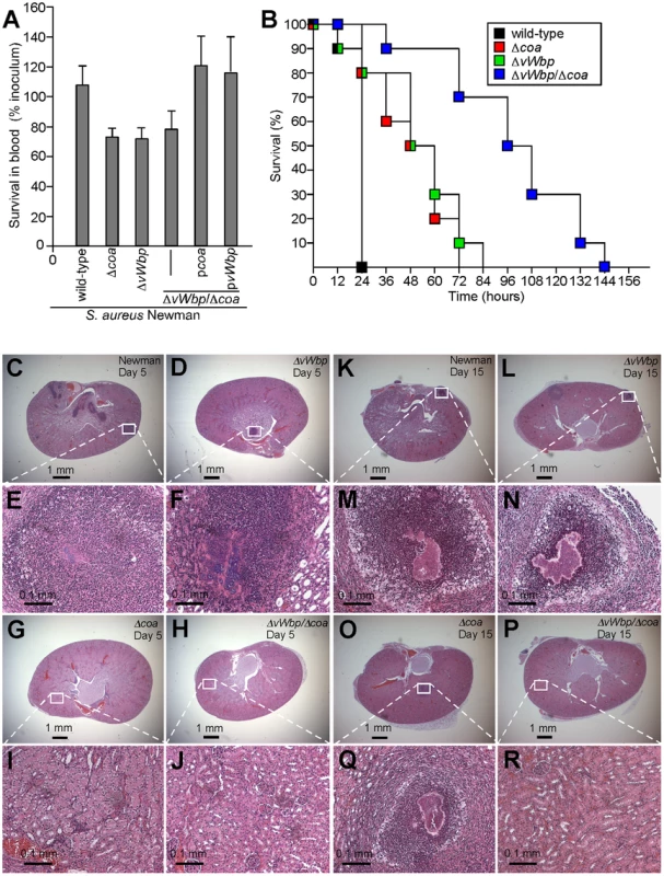 Contributions of <i>coa</i> and <i>vWbp</i> to bacterial survival in blood and <i>S. aureus</i> induced lethal bacteremia or renal abscess formation in mice.