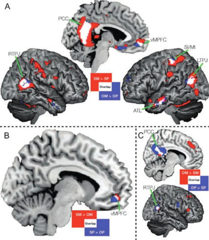 Výsledky tohoto experimentu lze nazvat „já a druhý člověk“ (25) Ukazují, které oblasti mozkové kůry uvede do činnosti uvažování o sobě nebo uvažování o druhém člověku a ve kterých místech se aktivita oblastí překrývá („overlap“). A vnitřní plocha levé mozkové hemisféry PCC – zadní cingulární kůra; vMPFC – ventrální („přední“) vnitřní prefrontální kůra, zevní plocha pravé mozkové hemisféry; RTPJ – kůra na hranicích spánkového a temenního laloku, zevní plocha levé mozkové hemisféry; SI/MI – primární senzorická kůra (SI), primární motorická kůra (MI); LTPJ – kůra na hranicích spánkového a temenního laloku; ATL – přední část spánkového laloku; SM – uvažování o sobě (self-mentalizing) v psychologických pojmech; OM – uvažování o známém druhém člověku (othermentalizing) v psychologických pojmech; SP – uvažování o sobě (self-physical) v tělesných pojmech; OP – uvažování o známém druhém člověku (other-physical) v tělesných pojmech SM („psychologické já“) v porovnání s SP („tělesné já“) červeně označené oblasti OM („psychologické já druhého člověka, kterého znám“) v porovnání s OP („tělesné já druhého člověka, kterého znám“) Bíle označené oblasti jsou místa, kde se překrývají reprezentace „já“ a „druhý člověk“. B vnitřní plocha levé mozkové hemisféry vMPFC – ventrální („přední“) vnitřní prefrontální kůra; červeně značené oblasti – porovnání aktivace SM vůči OM; modře značené oblasti – porovnání aktivace SP vůči OP; bíle značené oblasti odpovídají vzájemnému překrývání C vnitřní plocha levé mozkové hemisféry PCC – zadní cingulární kůra, zevní plocha pravé mozkové hemisféry; RTPJ – kůra na hranicích spánkového a temenního laloku; červeně značené oblasti – porovnání aktivace OM vůči SM; modře značené oblasti – porovnání aktivace OP vůči SP; bíle značené oblasti odpovídají vzájemnému překrývání