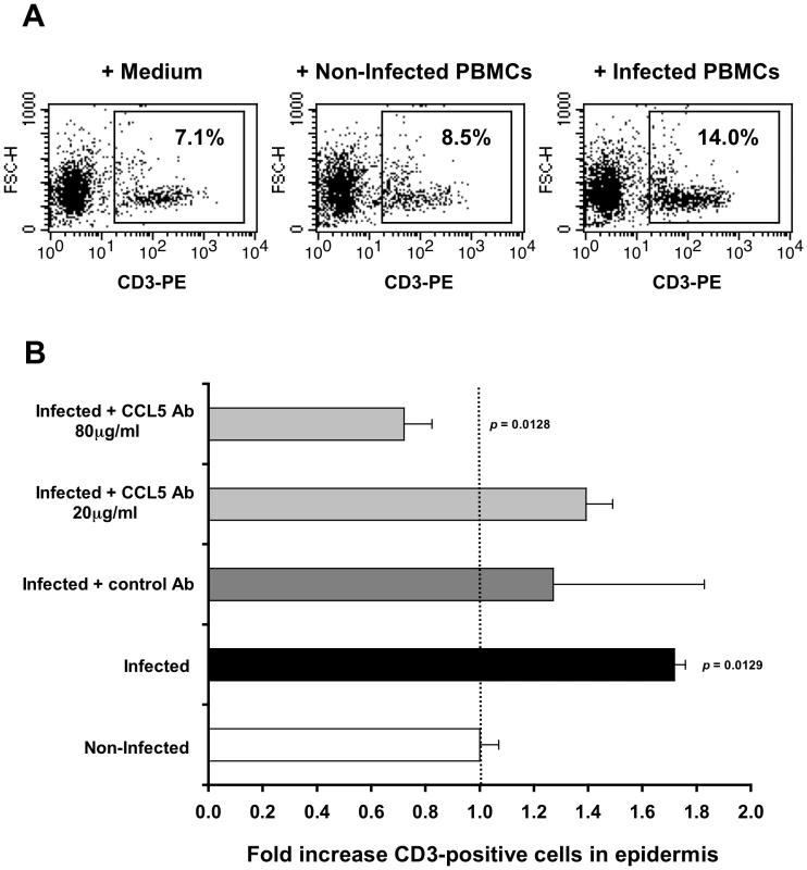 CCL5/RANTES mediates T-cell recruitment into the epidermis.