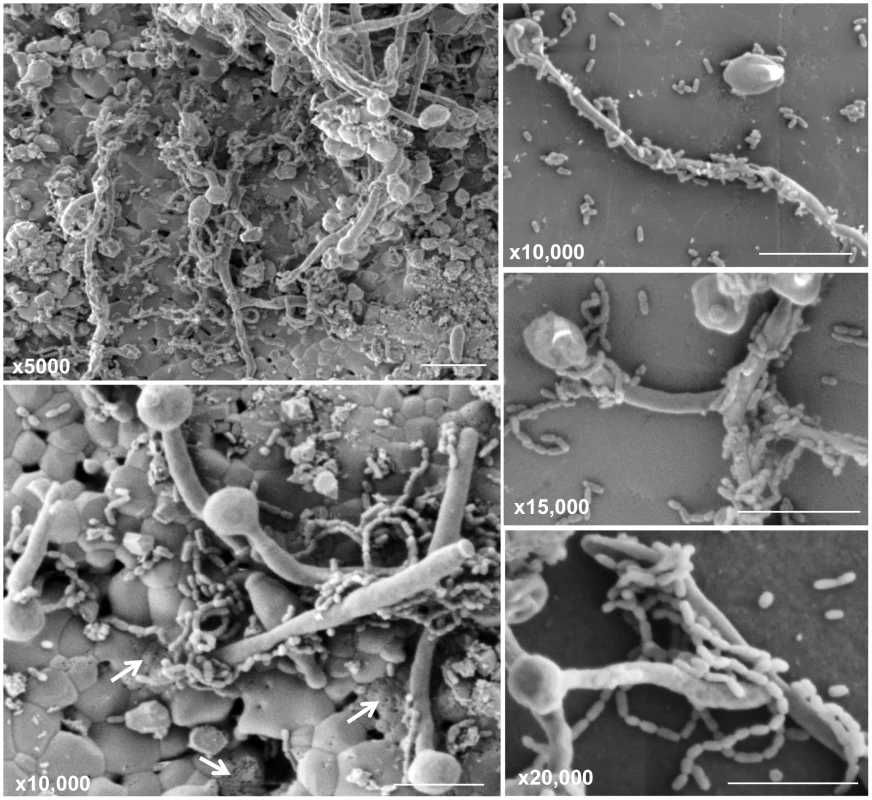 Scanning electron micrographs of mature mixed biofilms formed on discs of hydroxyapatite (a major component and essential ingredient of normal teeth), demonstrating the affinity of <i>S. mutans</i> to the hyphal elements of <i>C. albicans</i>.