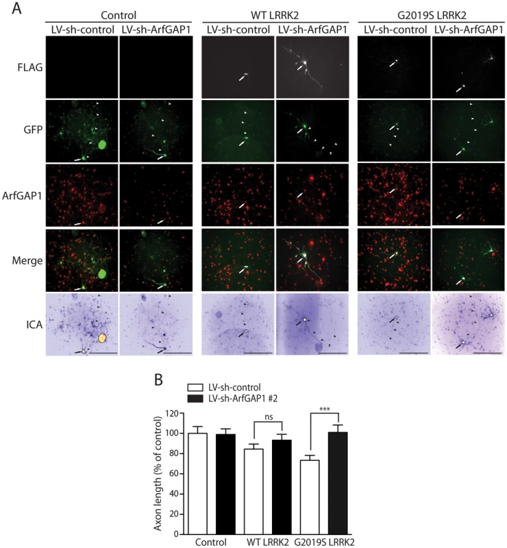 Silencing of ArfGAP1 expression rescues G2019S LRRK2-induced neurite shortening.