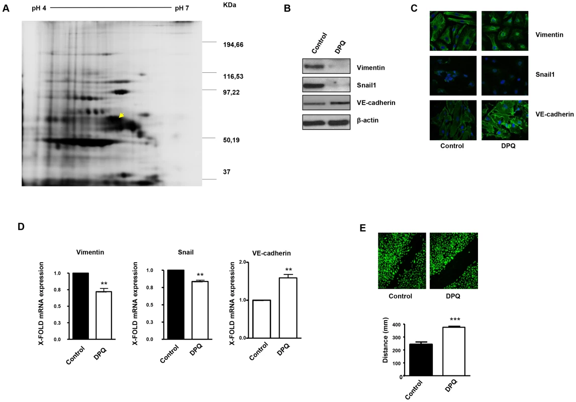 PARP inhibition down-regulates vimentin expression and inhibits endothelial-to-mesenchymal transition in HUVECs.