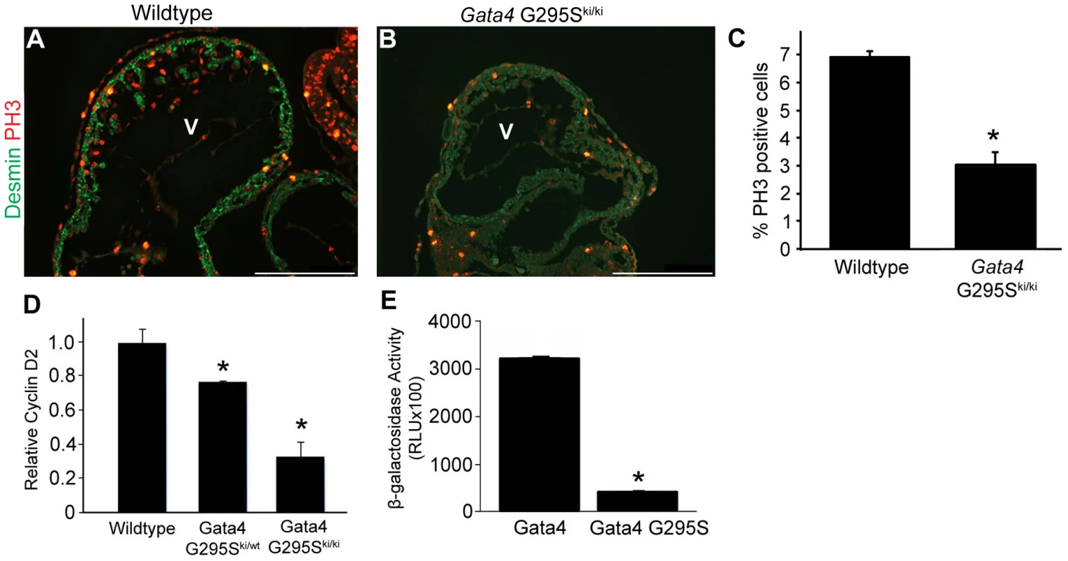G295S mutation in <i>Gata4</i> results in cardiomyocyte proliferation defects.