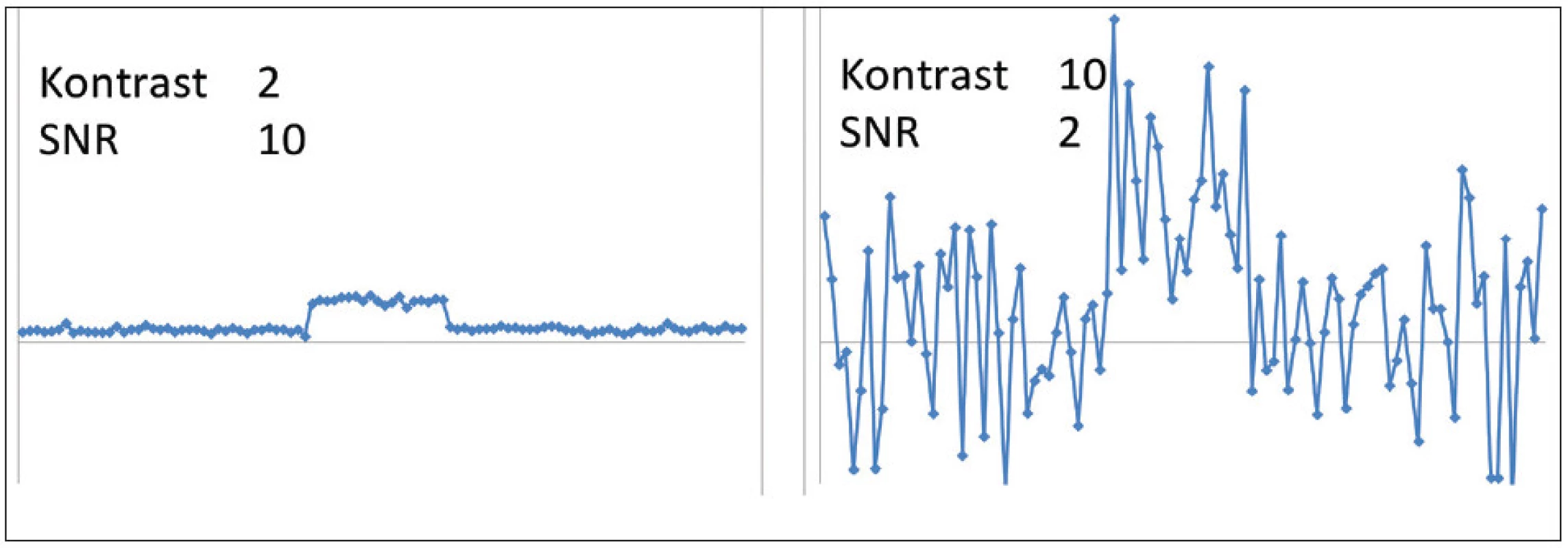 Ilustrace kvality zobrazení pro vysoký SNR a nízký kontrast (vlevo) a nízký SNR a vysoký kontrast (vpravo). Pro správnou detekci léze je nutné, aby obě veličiny byly dostatečně velké. Vzájemný vztah kontrastu a prostorového rozlišení byl v tomto příkladu zanedbán.