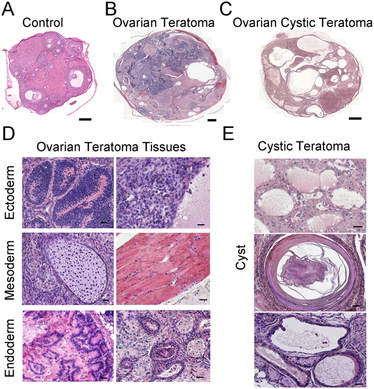 Formation of ovarian teratomas in mice with conditional <i>Rb1</i> inactivation in oocytes.