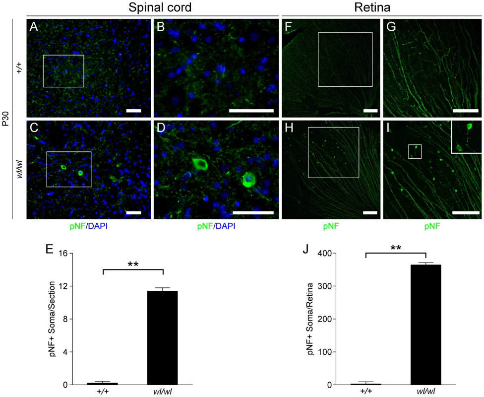 Phosphorylated neurofilament (pNF) accumulates in somas of spinal cord neurons and retinal ganglion cells in <i>wl/wl</i> mice.