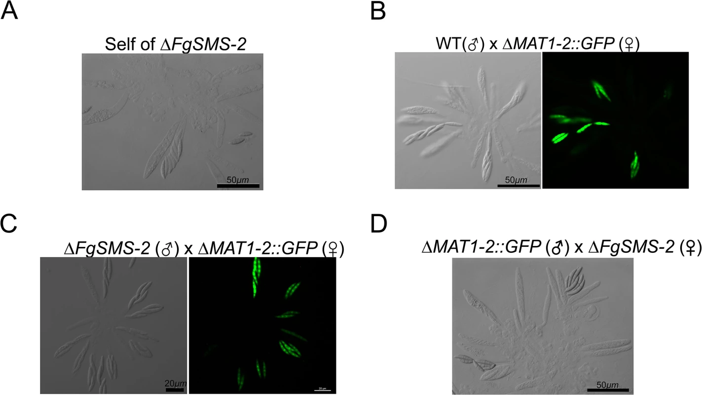 Morphology of asci and ascospores produced in the self-cross of Δ<i>FgSMS-2</i> (A) and outcrosses between WT(♂) and Δ<i>MAT1-2</i>::<i>GFP</i>(♀) (B), between Δ<i>FgSMS-2</i>(♂) and Δ<i>MAT1-2</i>::<i>GFP</i>(♀) (C), and between Δ<i>MAT1-2</i>::<i>GFP</i>(♂) and Δ<i>FgSMS-2</i>(♀) (D).