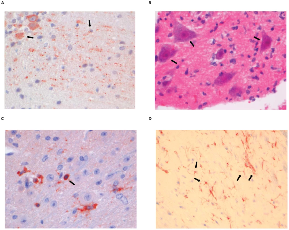Histopathology of 8-week old BALB/c mice infected i.m. with 10<sup>6</sup> TCID<sub>50</sub> of SHBRV-18.