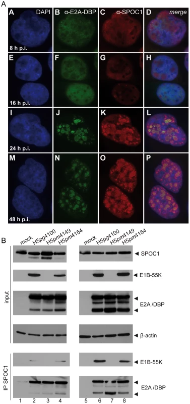 SPOC1 is recruited to Ad replication centers during infection.