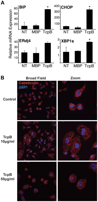 TcpB protein induces UPR and ER restructuring.