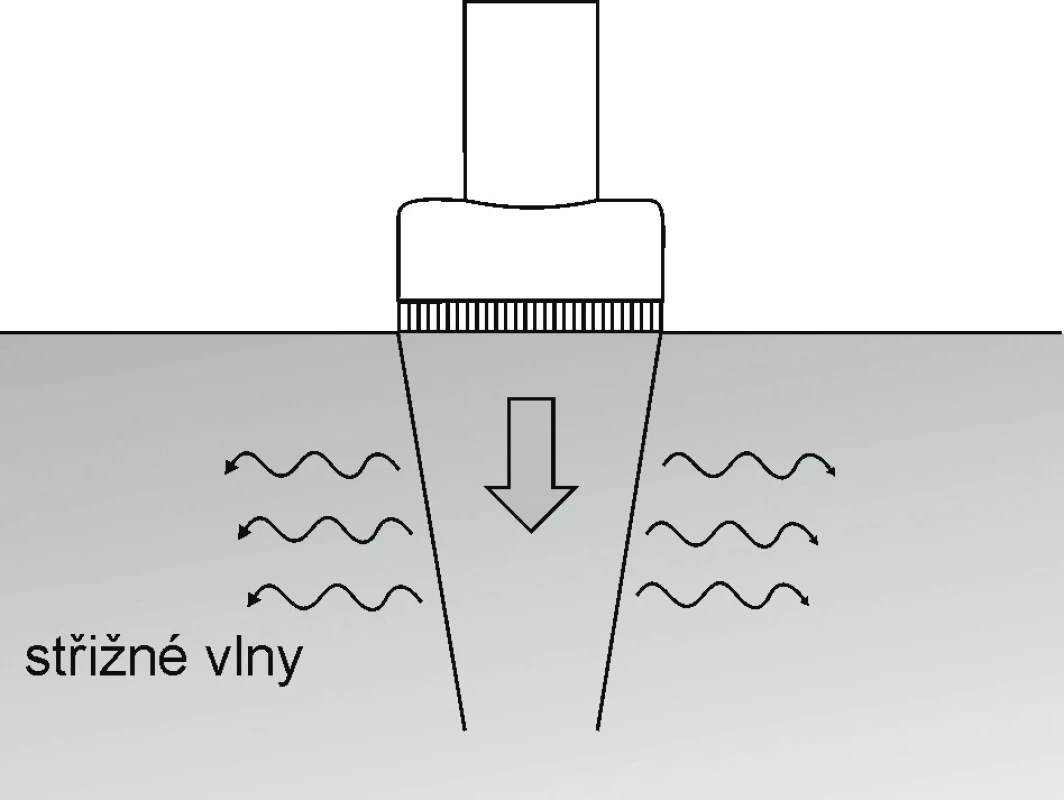 Princip shear wave elastografie – měření rychlosti střižných vln