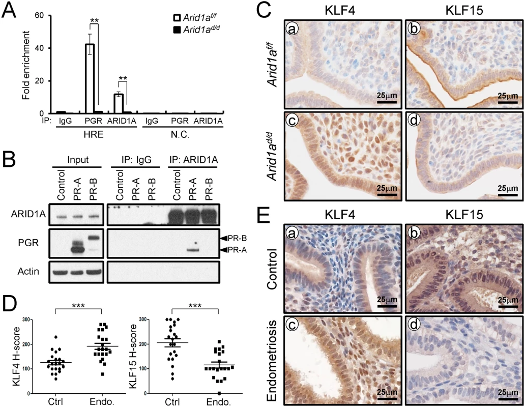 ARID1A regulates epithelial proliferation via modulating KLF15 expression with PGR (A) ChIP assay performed with uterine chromatin isolated <i>Arid1a</i><sup><i>f/f</i></sup> and <i>Arid1a</i><sup><i>d/d</i></sup> mice at 3.5 dpc using IgG, PGR, and ARID1A antibodies followed by qPCR.